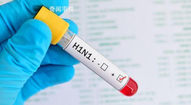 俄羅斯全境均出現甲型H1N1 目前尚無動物傳染人類的證據