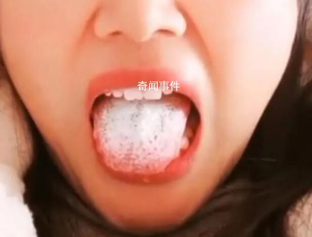 女子陽后舌頭長滿厚白舌苔 讓網友議論紛紛