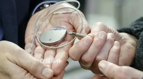 羅馬尼亞5醫(yī)生取死者人工心臟再用 被刑事調(diào)查