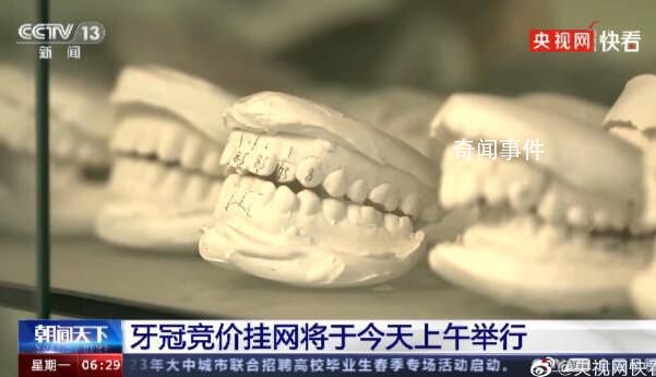 種牙費用有望降低50% 價格調(diào)控目標(biāo)為4500元