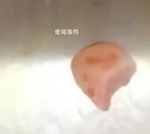 女子摔跤上牙磕進嘴唇1月后才發現 嘴唇一直紅腫且伴有刺痛