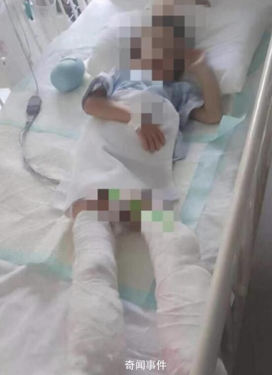 被生母虐待致截肢男童父親再發聲 希望能保住眼睛