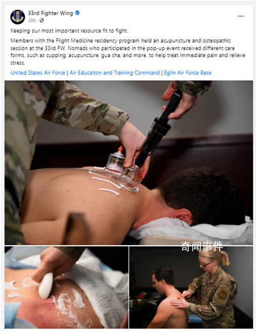 美軍曬士兵拔火罐照片 為保持戰斗力