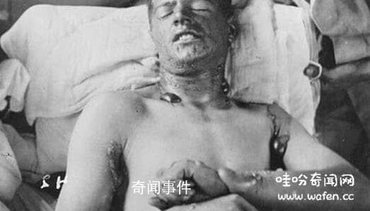 中國所遭受的化學(xué)戰(zhàn)爭 十個化學(xué)戰(zhàn)的可怕之處 化學(xué)戰(zhàn)有多么可怕
