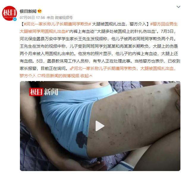 男生遭同學欺負大腿被圓規扎出血 教體局工作人員稱有專人正在處理此事