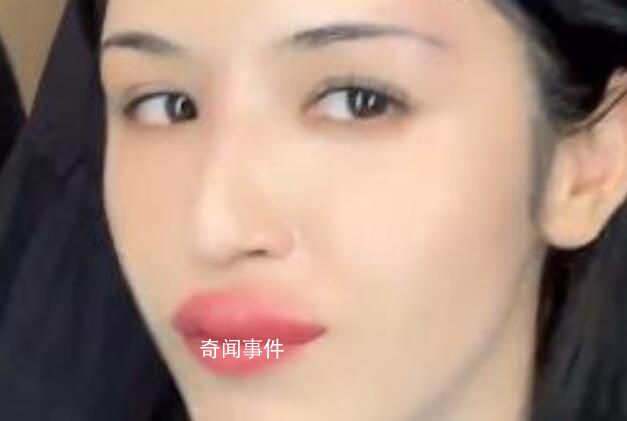 哈妮克孜被蚊子咬成香腸嘴 標注：這是一個悲傷的故事請大家嚴肅觀看