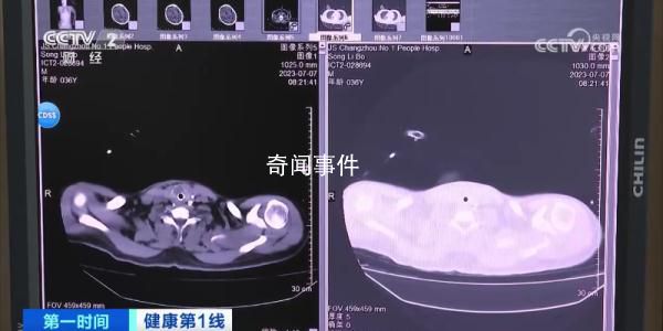 36歲男子吹空調(diào)住進(jìn)ICU 如何預(yù)防空調(diào)病