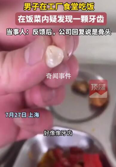 男子稱在公司食堂疑似吃出牙齒 此事引發(fā)關(guān)注