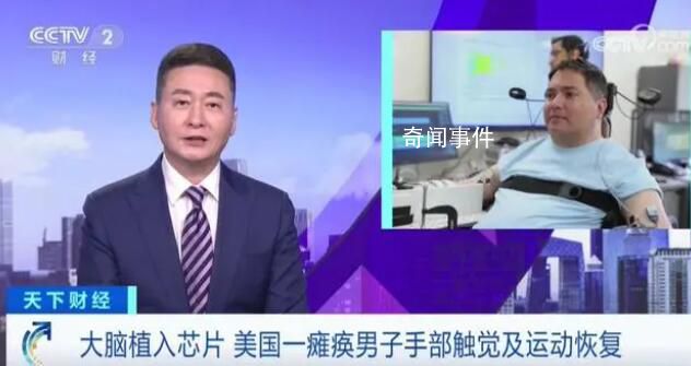 癱瘓男子大腦植入芯片觸覺恢復(fù) 實(shí)在是太神奇了