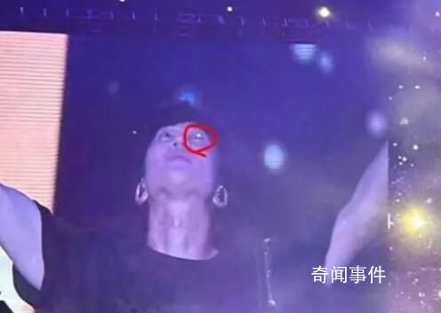 林俊杰被激光筆照眼 為何會有人做出如此惡劣的行徑