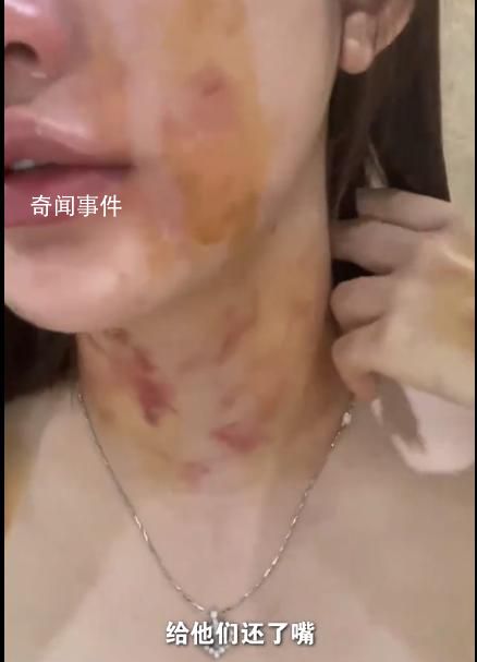 23歲女子自曝遭夫妻兩人毆打扒衣 當(dāng)事雙方按照流程做傷情鑒定