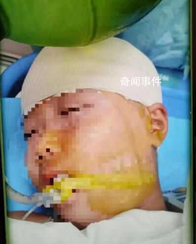 被打破頭骨女生已清醒?家屬回應