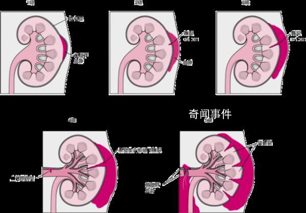 女生經期用按摩儀按腰致腎破裂 這些情況切記不要亂按摩