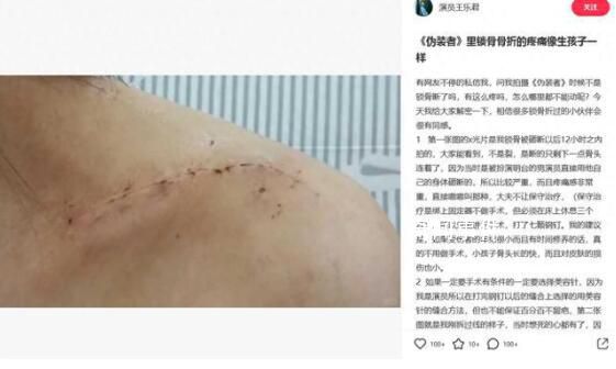 胡歌被曝拍偽裝者時(shí)砸斷女主鎖骨 并怒懟胡歌粉絲