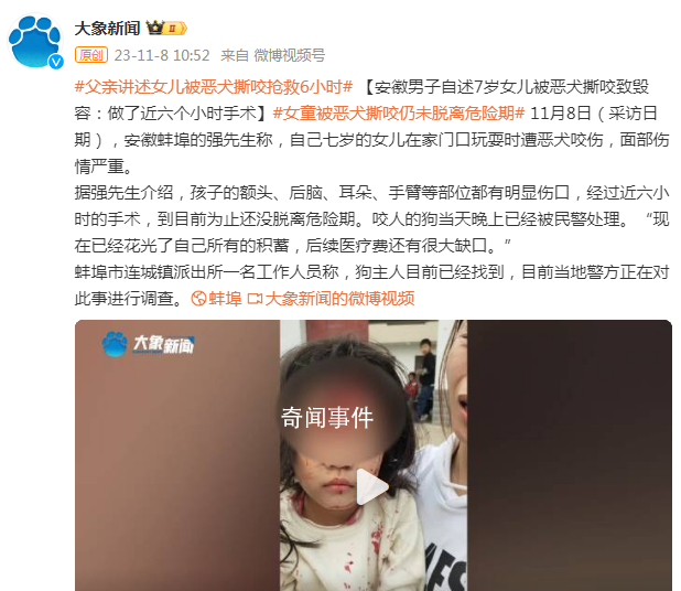安徽7歲女童被惡犬撕咬致毀容 目前當(dāng)?shù)鼐秸趯?duì)此事進(jìn)行調(diào)查