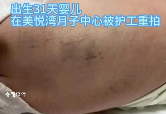 陜西月子會(huì)所護(hù)工把嬰兒打成腦損傷