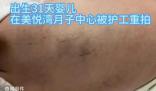 陜西月子會(huì)所護(hù)工把嬰兒打成腦損傷