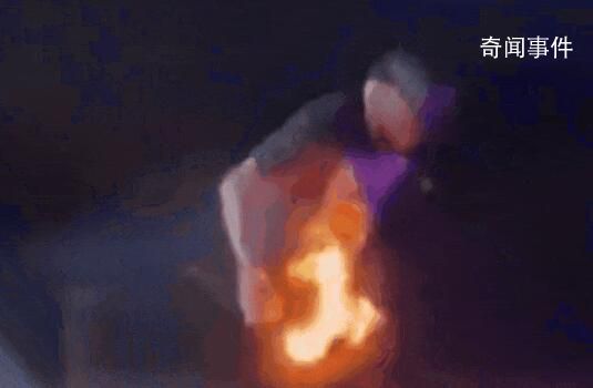 歌手演出被噴火裝置射中褲襠 已對(duì)傷口進(jìn)行處理