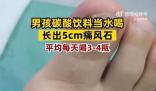 男孩1天4瓶飲料長(zhǎng)5厘米痛風(fēng)石 目前患者恢復(fù)良好