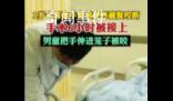 男童手臂伸進籠子被藏獒咬斷 手術(shù)差不多花了6個小時
