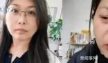 女子自稱20天內“老了30多歲” 引發(fā)網(wǎng)友關注