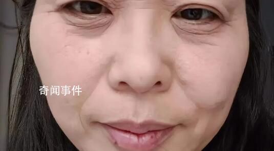 斷崖式衰老女子本以為能漂亮過(guò)余生 引發(fā)網(wǎng)友熱議