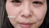 斷崖式衰老女子本以為能漂亮過(guò)余生 引發(fā)網(wǎng)友熱議
