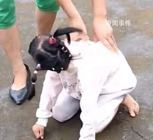 網紅袖珍女孩疑遭母親虐待 肢體2級殘疾