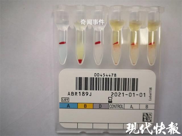 江蘇泰州發(fā)現(xiàn)罕見(jiàn)小p血型 我國(guó)記錄在案的小p血型僅有10余人