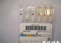 江蘇泰州發(fā)現(xiàn)罕見(jiàn)小p血型 我國(guó)記錄在案的小p血型僅有10余人