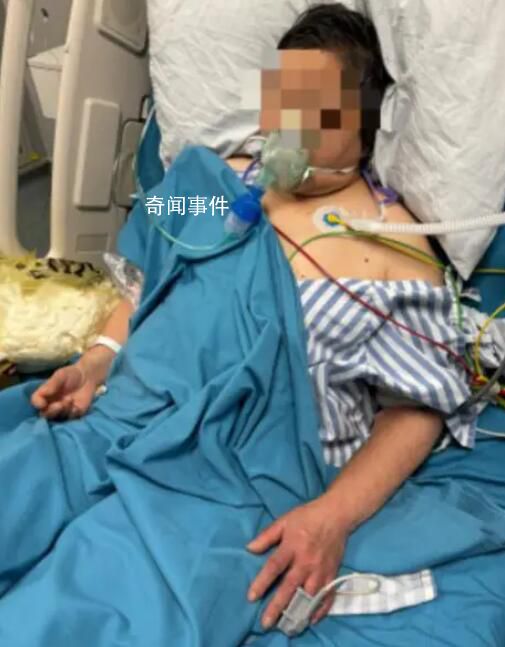 夫妻宰殺活鴨被抓傷住進(jìn)ICU 倆人先后出現(xiàn)寒戰(zhàn)發(fā)熱的癥狀